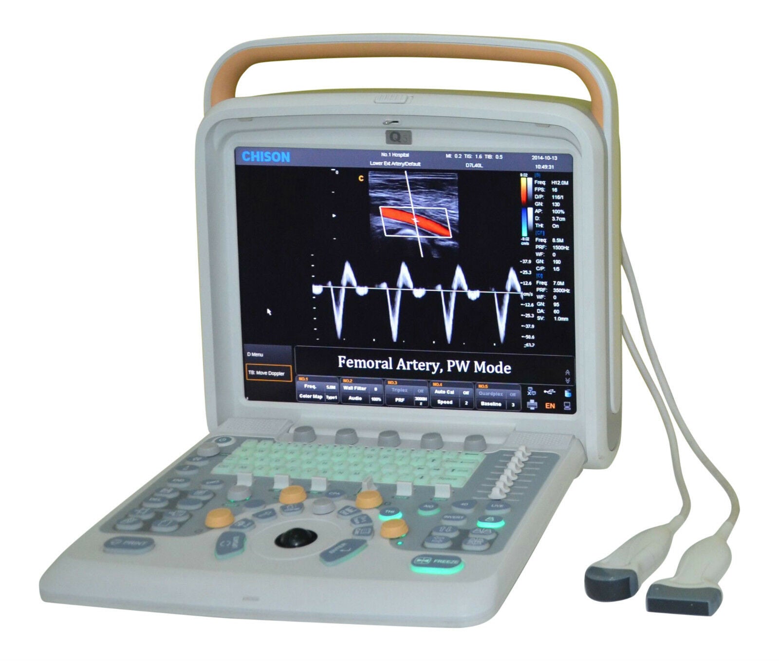 Ultrasound Chison Q5 with 3 probes: Linear Array,Convex, TV DIAGNOSTIC ULTRASOUND MACHINES FOR SALE