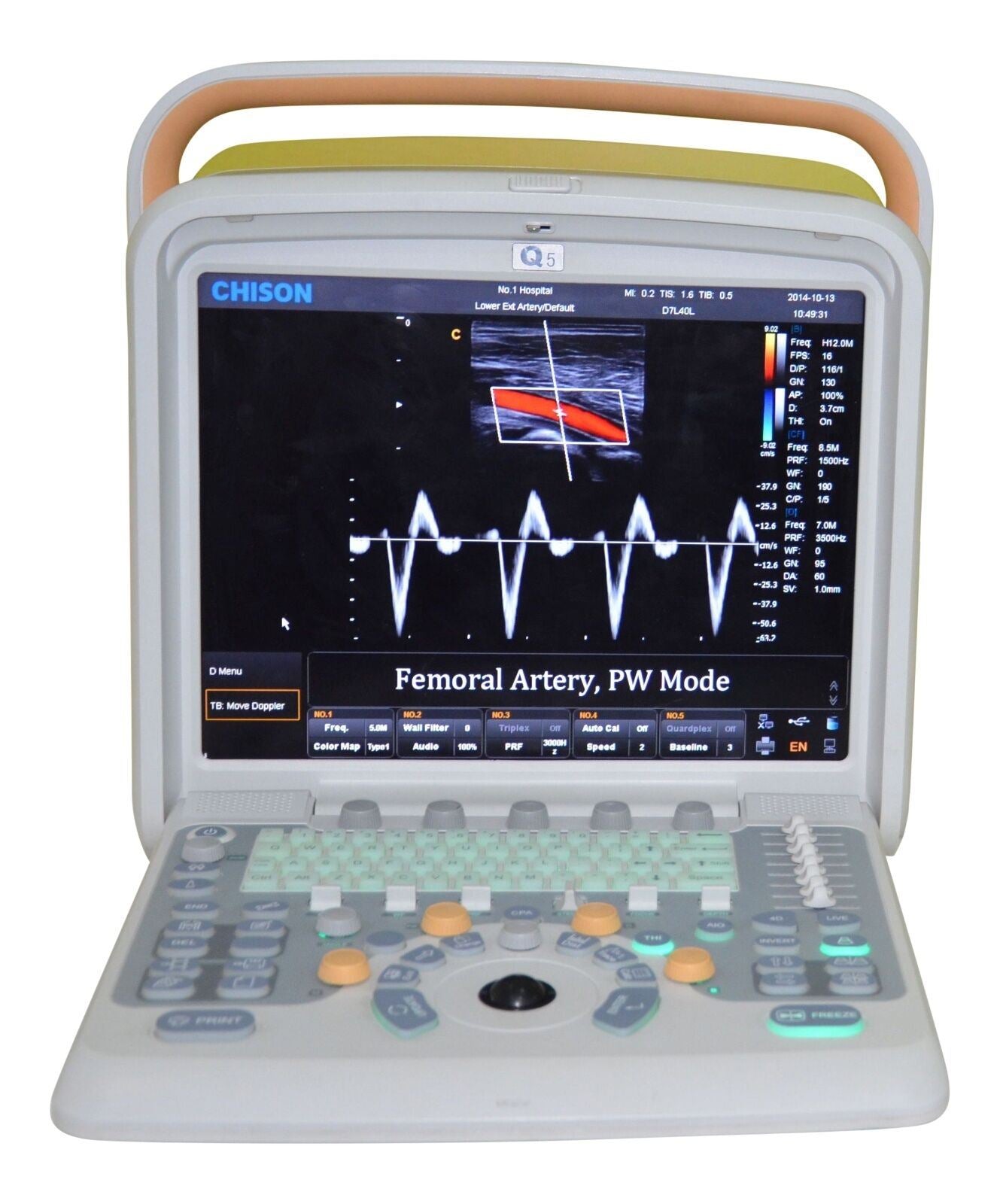 Veterinary Ultrasound Scanner with one Probes - Color Doppler Chison Q5Vet DIAGNOSTIC ULTRASOUND MACHINES FOR SALE