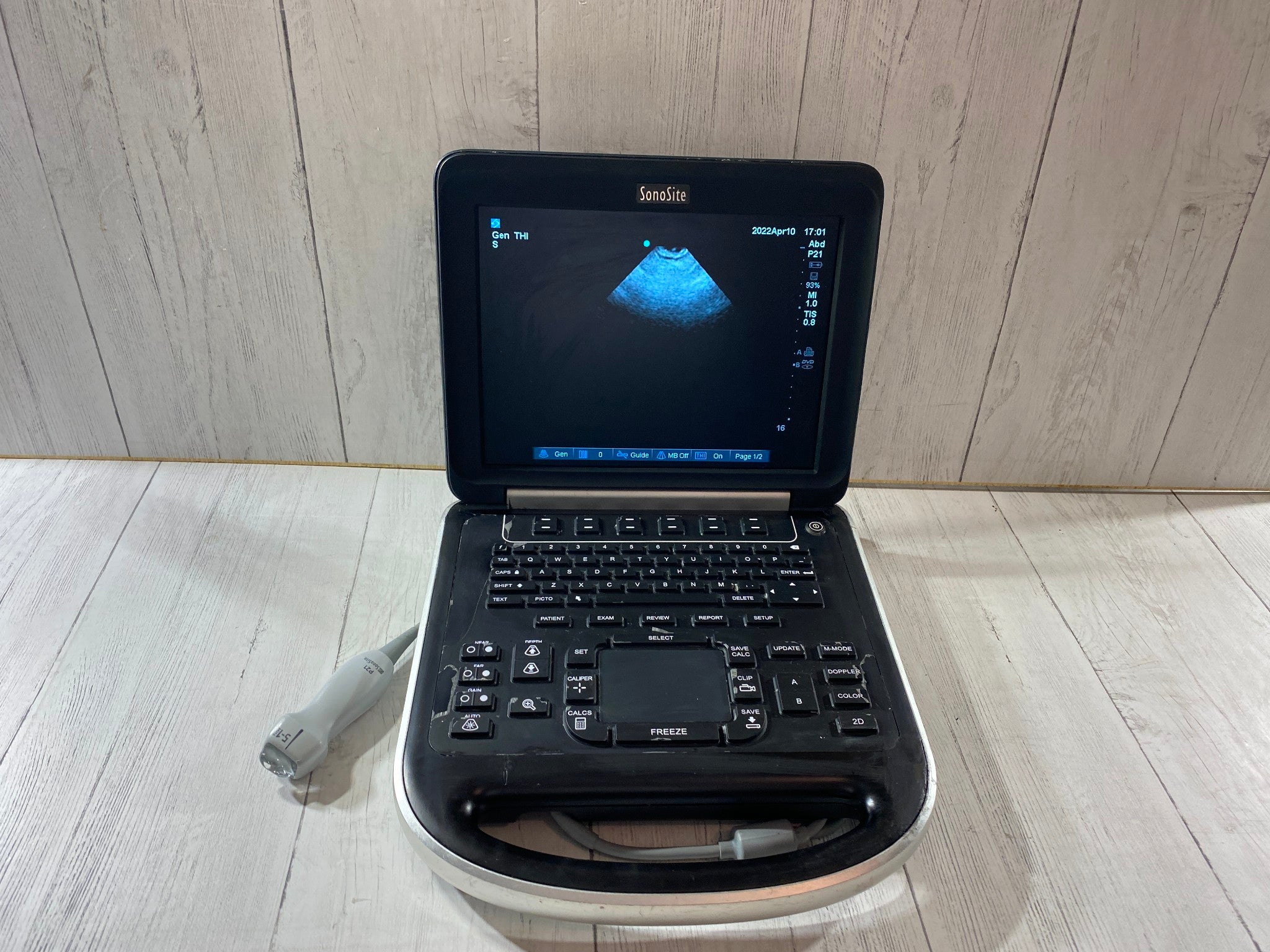 Sonosite Edge Portable ultrasound Manufactured 2013 with P21 Cardiac probe DIAGNOSTIC ULTRASOUND MACHINES FOR SALE