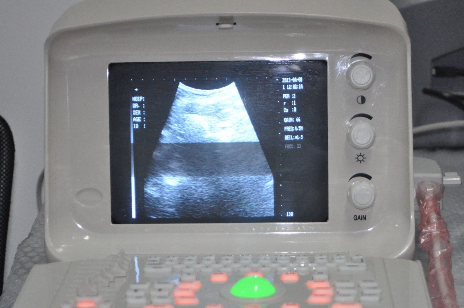 Portable Digital Ultrasound Scanner Machine System 5.0MHz Micro Convex Probe 3D 190891303288 DIAGNOSTIC ULTRASOUND MACHINES FOR SALE