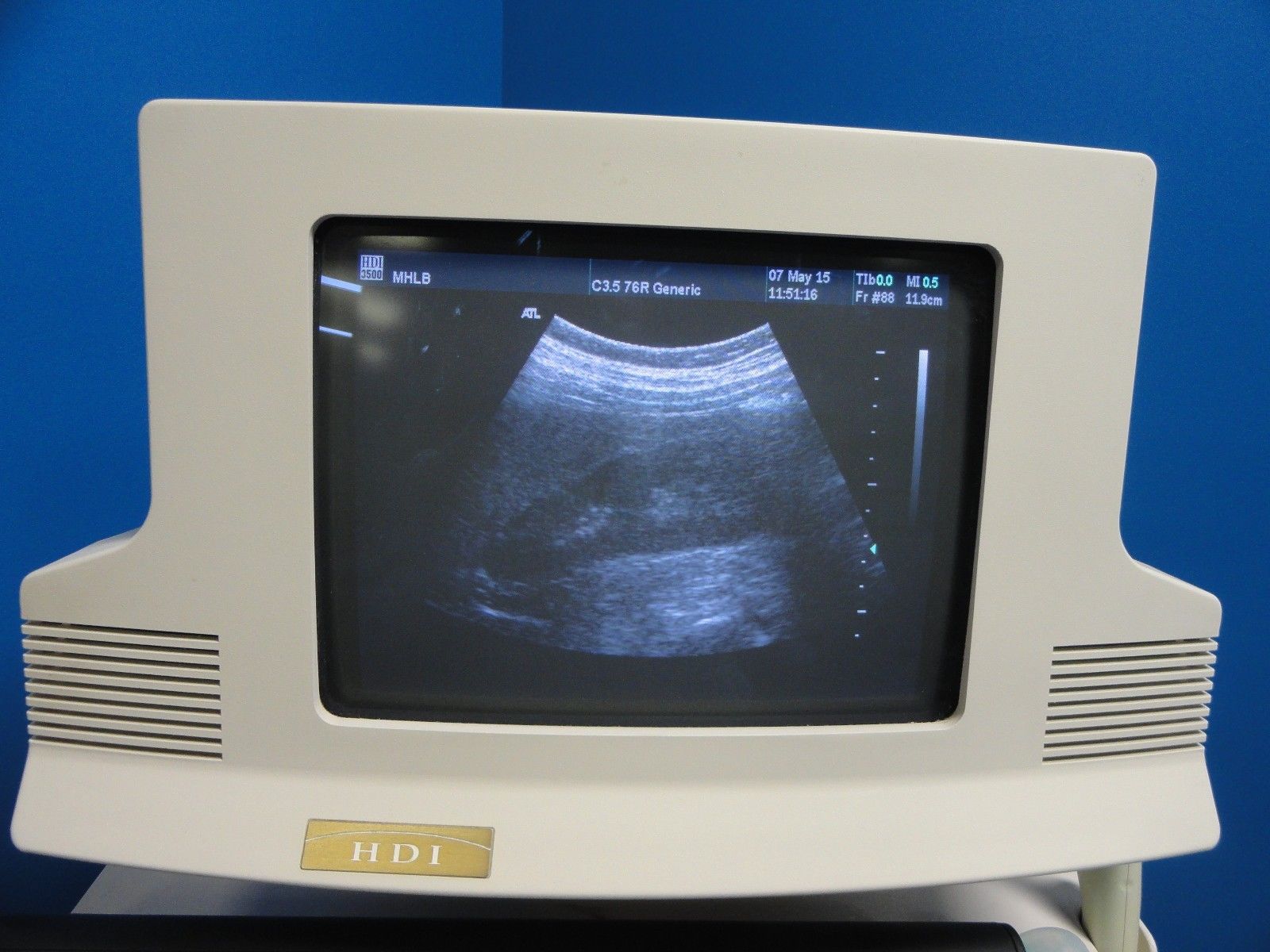 ATL C3.5 76R Convex / Curved Array Ultrasound Transducer Probe (8841) DIAGNOSTIC ULTRASOUND MACHINES FOR SALE