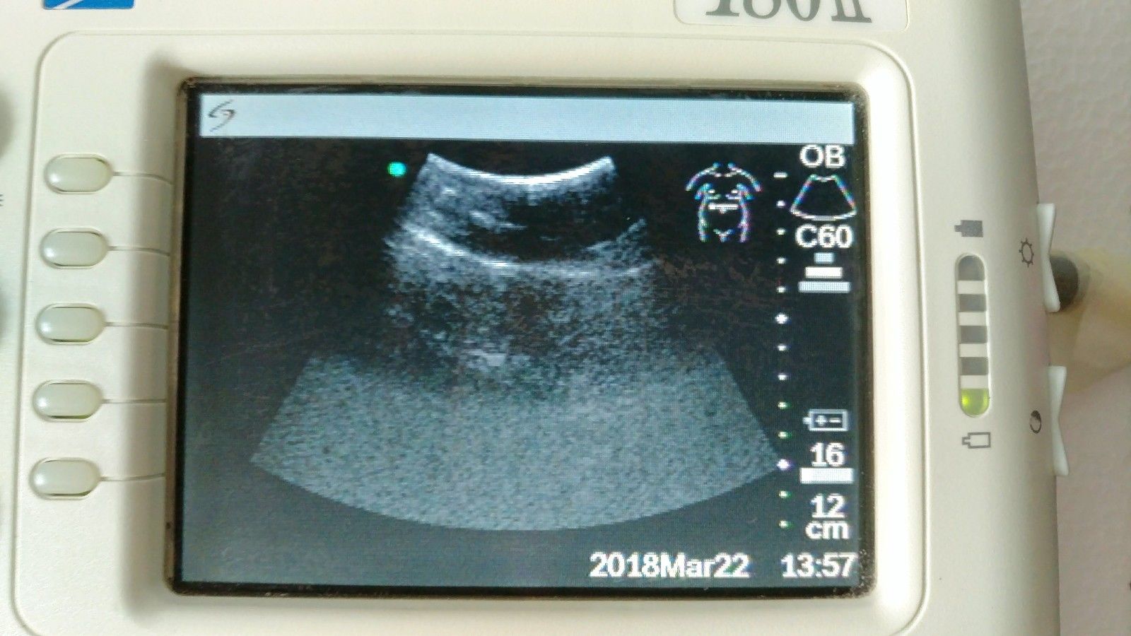 Sonosite 180 II portable ultrasound system MODULE + POWER SUPPLY P02456-02 DIAGNOSTIC ULTRASOUND MACHINES FOR SALE