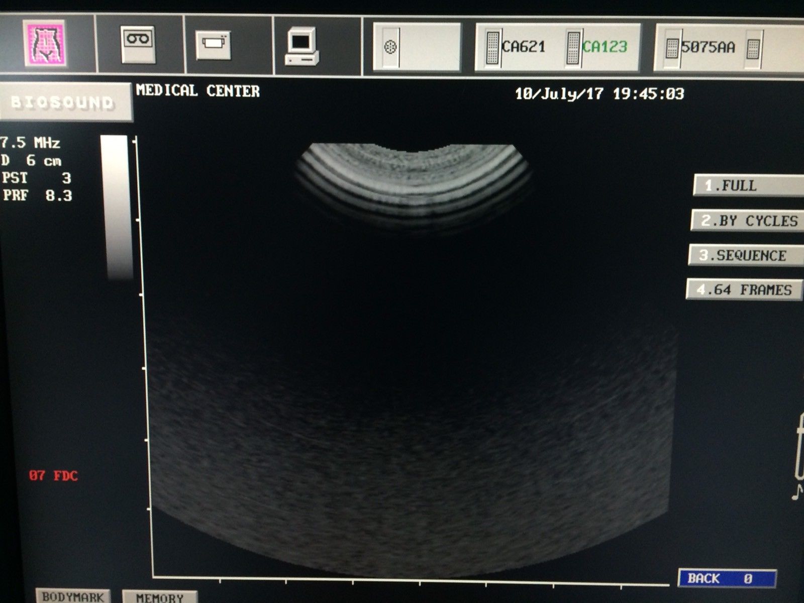 Esaote Biosound, MyLab ultrasound CA123 micro convex probe DIAGNOSTIC ULTRASOUND MACHINES FOR SALE