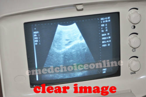 Professional Portable Digital Ultrasound Scanner Transvaginal Probe +3D Software 190891732514 DIAGNOSTIC ULTRASOUND MACHINES FOR SALE