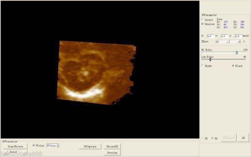 Portable Digital Ultrasound machine Scanner+3.5Mhz convex Probe+*3Dworkstation** 190891888099 DIAGNOSTIC ULTRASOUND MACHINES FOR SALE