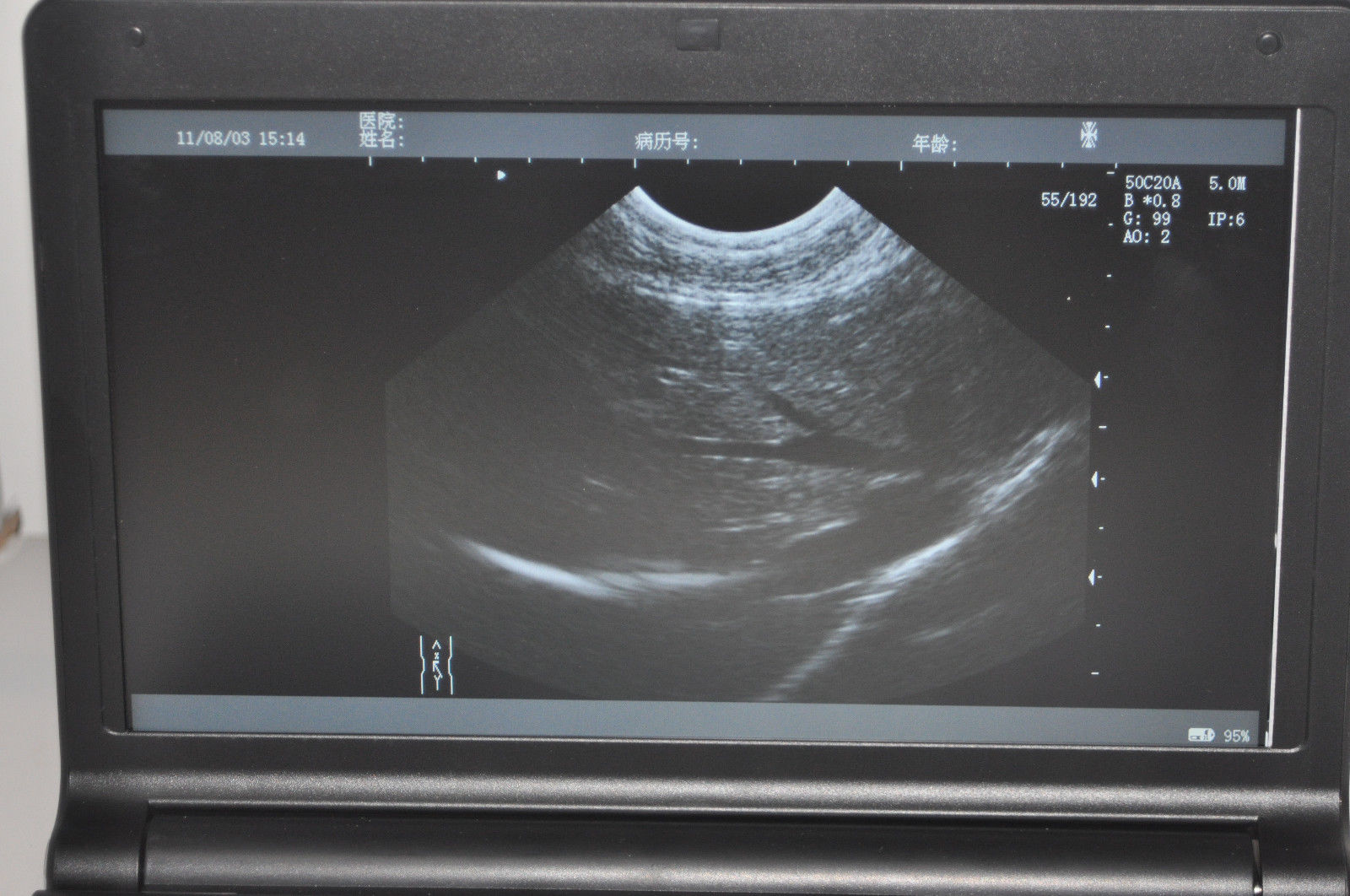 Digital Portable Ultrasound Machine Scanner System Convex Probe 3D + PR Oximeter DIAGNOSTIC ULTRASOUND MACHINES FOR SALE