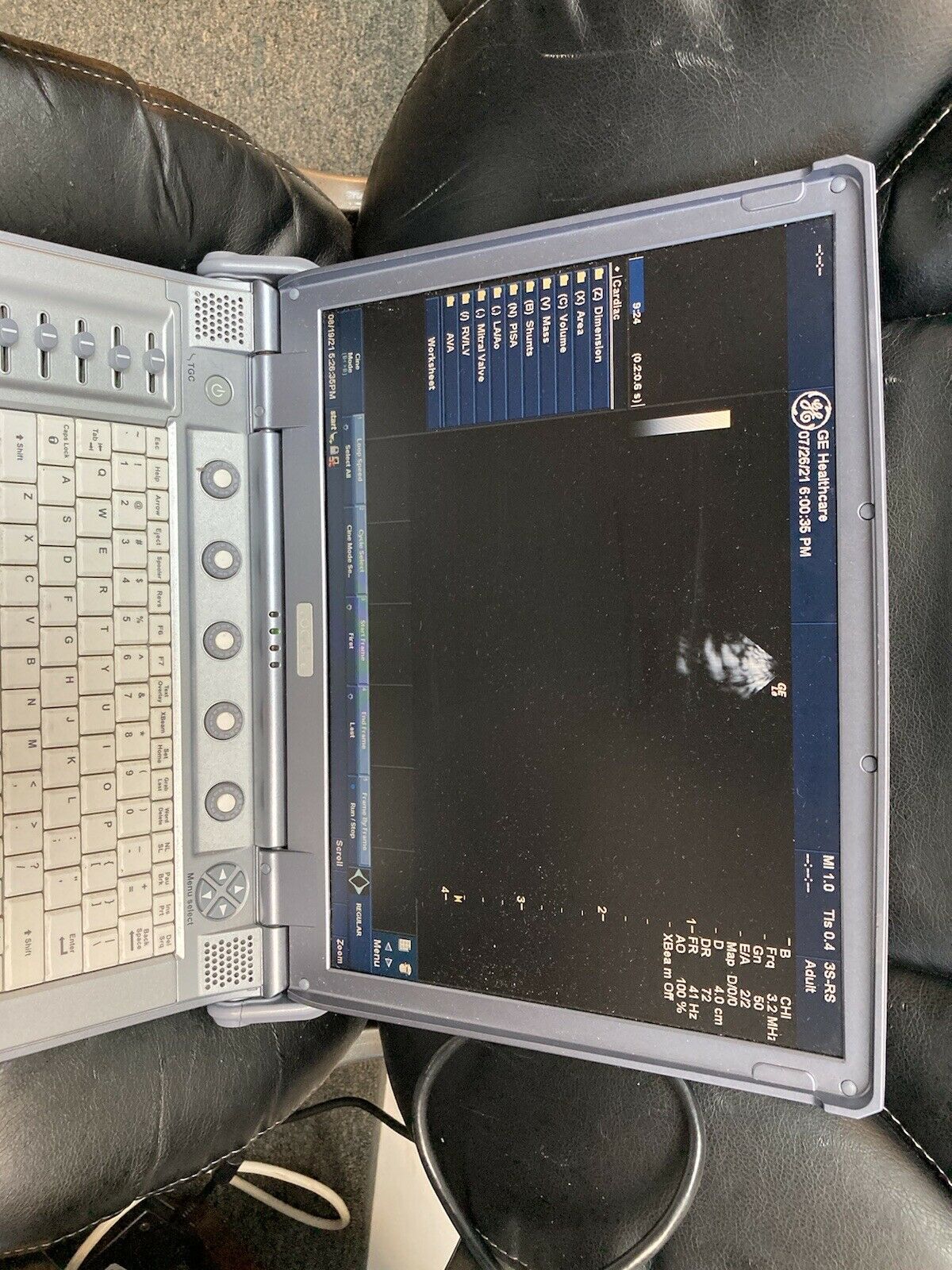 GE Logiq E portable ultrasound model 5199704/5122757 DIAGNOSTIC ULTRASOUND MACHINES FOR SALE