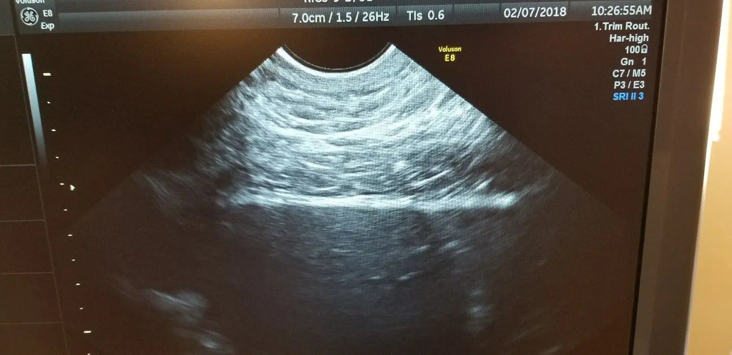 GE RIC5-9-D Ultrasound Transducer / Probe DIAGNOSTIC ULTRASOUND MACHINES FOR SALE