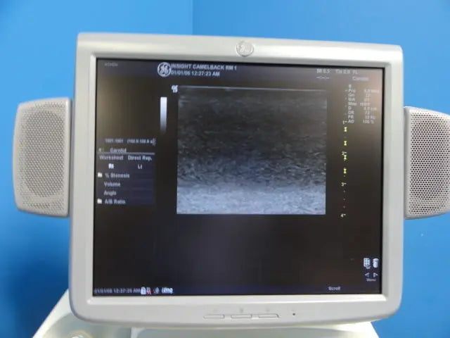 GE 7L Linear Array Ultrasound Transducer for Logiq & Vivid Series (10760) DIAGNOSTIC ULTRASOUND MACHINES FOR SALE