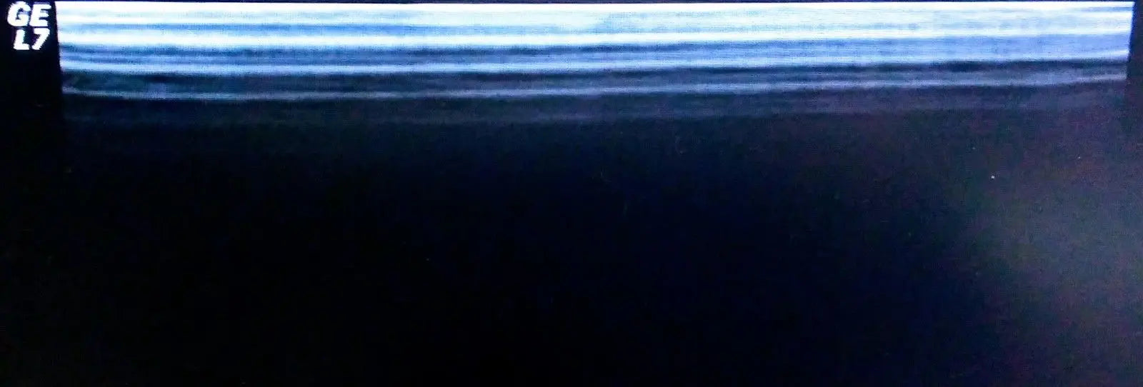 GE 10L Linear Ultrasound Transducer for GE Logiq Systems DIAGNOSTIC ULTRASOUND MACHINES FOR SALE