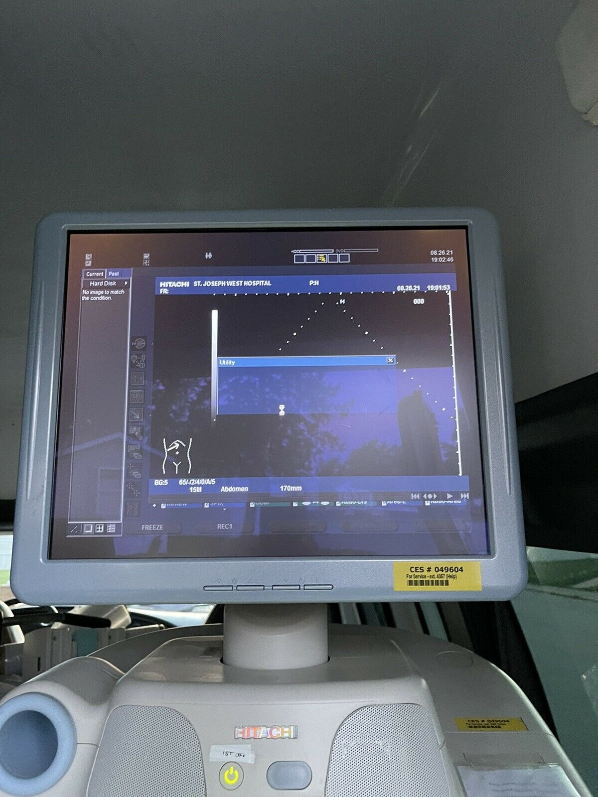 Hitachi Hi Vision 900 Ultrasound Machine DIAGNOSTIC ULTRASOUND MACHINES FOR SALE