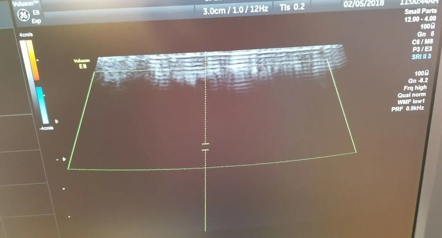 GE SP10-16-D Ultrasound Probe / Transducer DIAGNOSTIC ULTRASOUND MACHINES FOR SALE