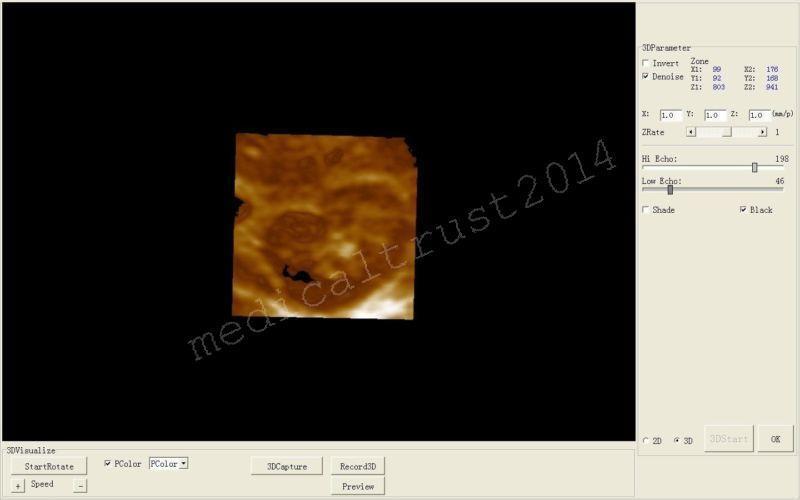 Free 3D LCD Digital Ultrasound System Scanner Machine+Convex Transvaginal Probes DIAGNOSTIC ULTRASOUND MACHINES FOR SALE