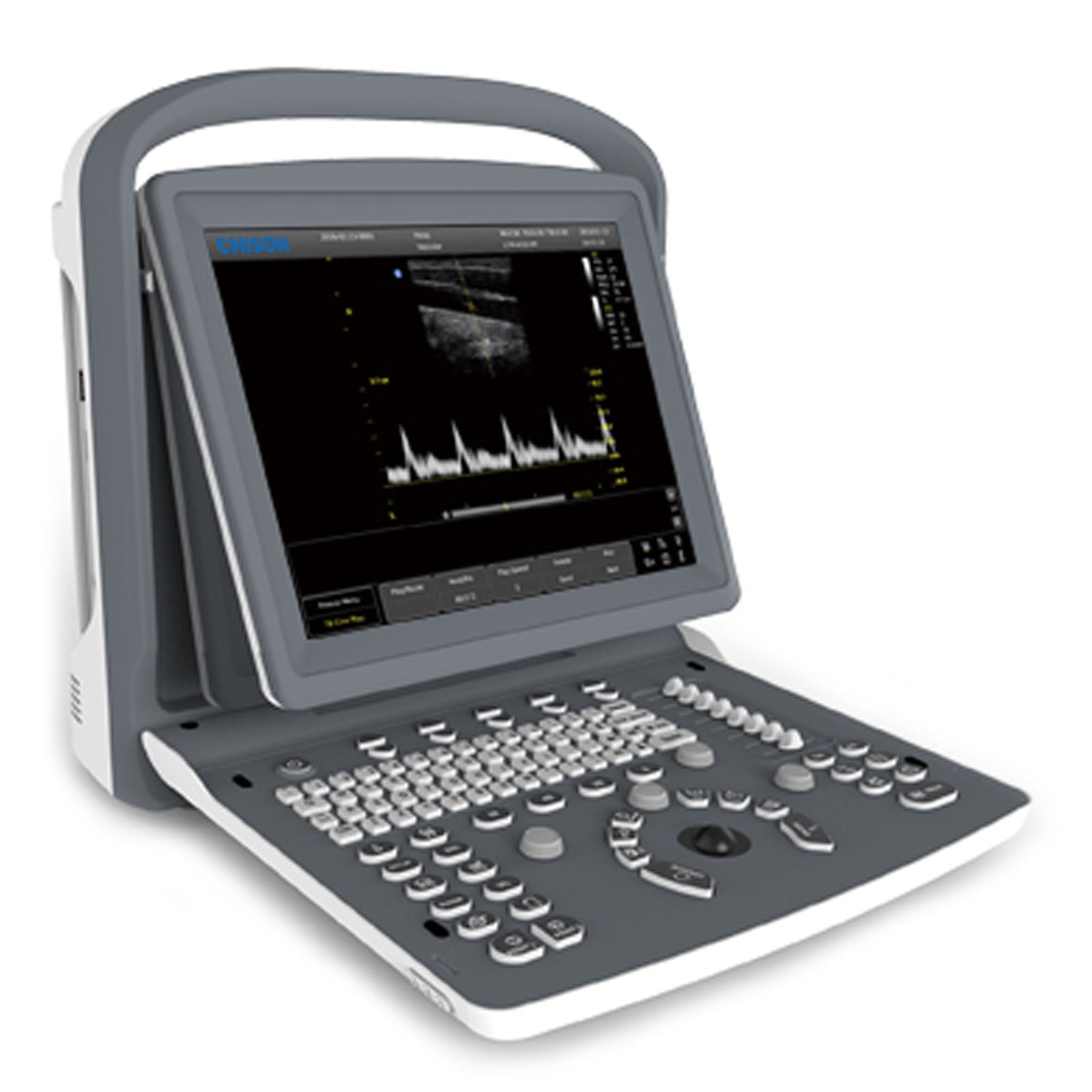 ECO2 Chison Portable Digital Ultrasound Scanner+3.5MHz ConvexProbe+CASE 2016 eee DIAGNOSTIC ULTRASOUND MACHINES FOR SALE