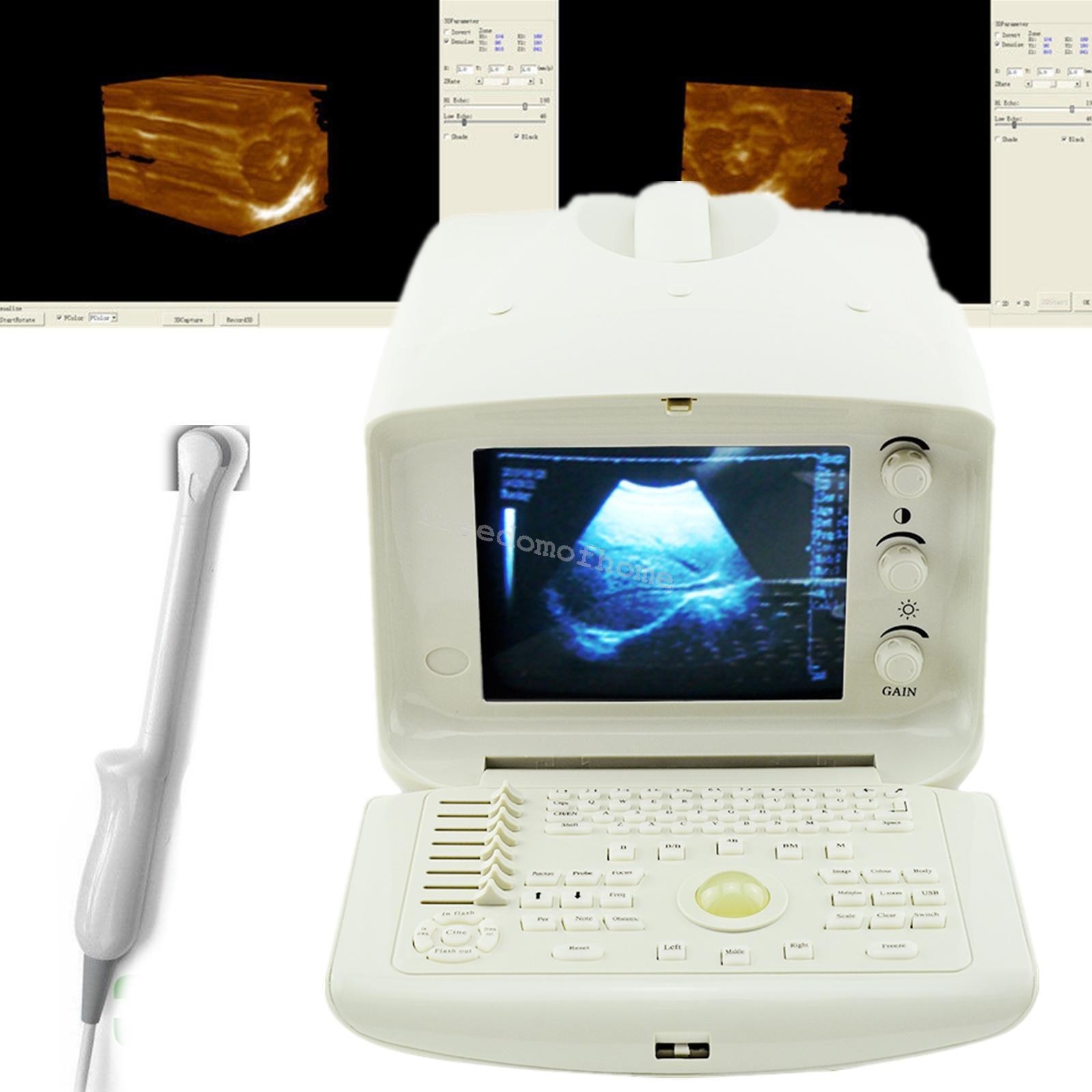 Full Digital Portable Ultrasound Scanner machine +Convex + Vignial 2 Probes+3D DIAGNOSTIC ULTRASOUND MACHINES FOR SALE