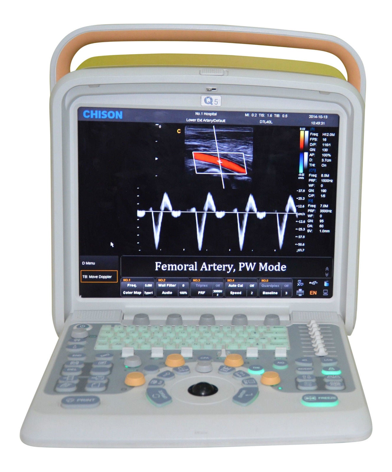 Color Doppler Ultrasound Scanner & Two probes Convex&Linear Probe - Chison Q5 DIAGNOSTIC ULTRASOUND MACHINES FOR SALE