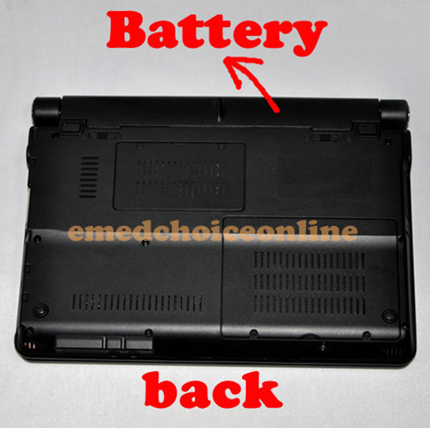 Full Digital Laptop Ultrasound Scanner Covex + Linear 2 Probes 9000F Sale CE 190891787651 DIAGNOSTIC ULTRASOUND MACHINES FOR SALE