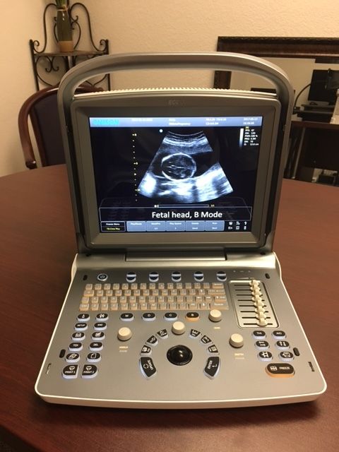 NEW Chison ECO 6 Portable Ultrasound System DIAGNOSTIC ULTRASOUND MACHINES FOR SALE