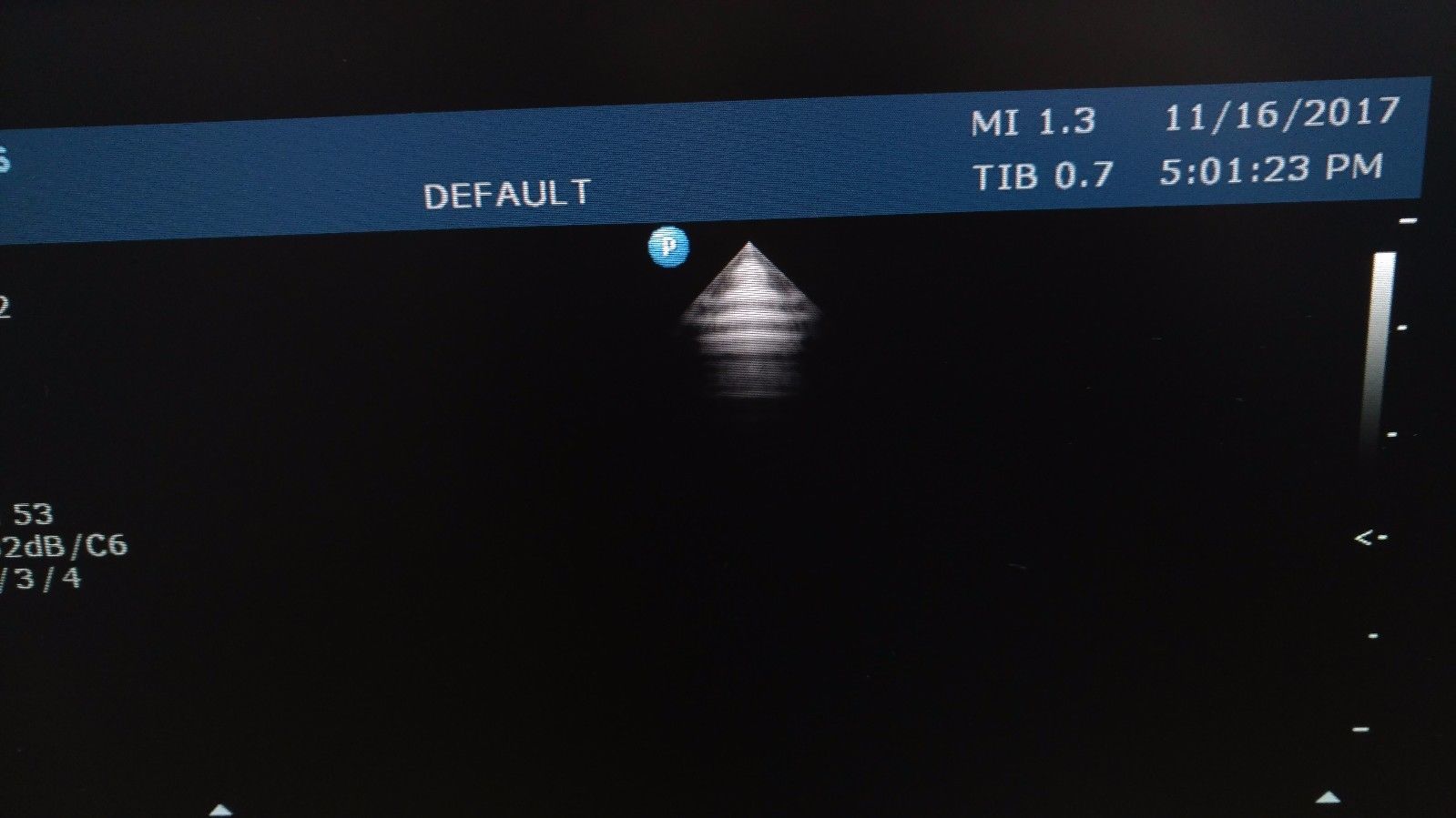 a screen with a medical imaging