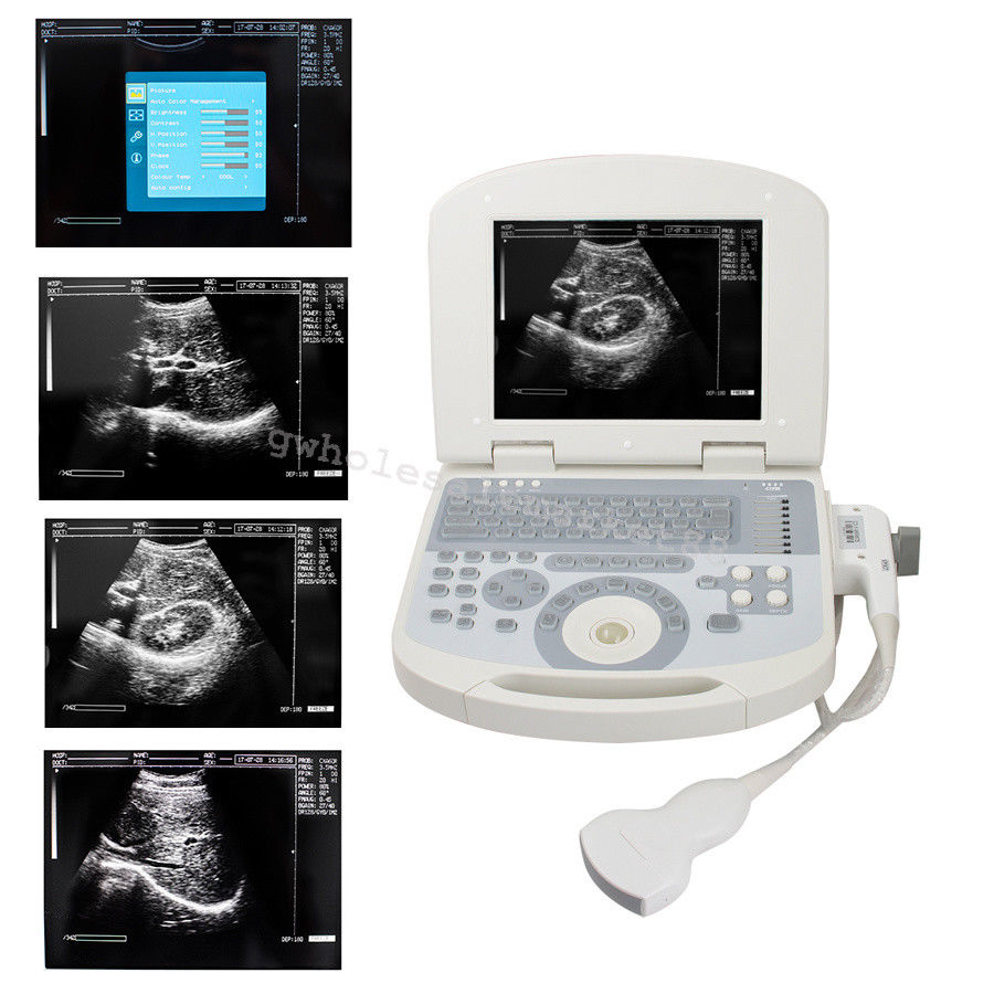 Laptop Ultrasound Machine Scanner Convex Probe 3D Software High Resolution Clear 190891045898 DIAGNOSTIC ULTRASOUND MACHINES FOR SALE