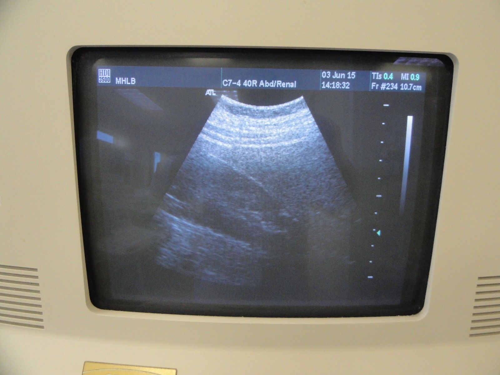 ATL C7-4 40R Curved Array Convex Abdominal Probe for ATL HDI Series (8938 ) DIAGNOSTIC ULTRASOUND MACHINES FOR SALE