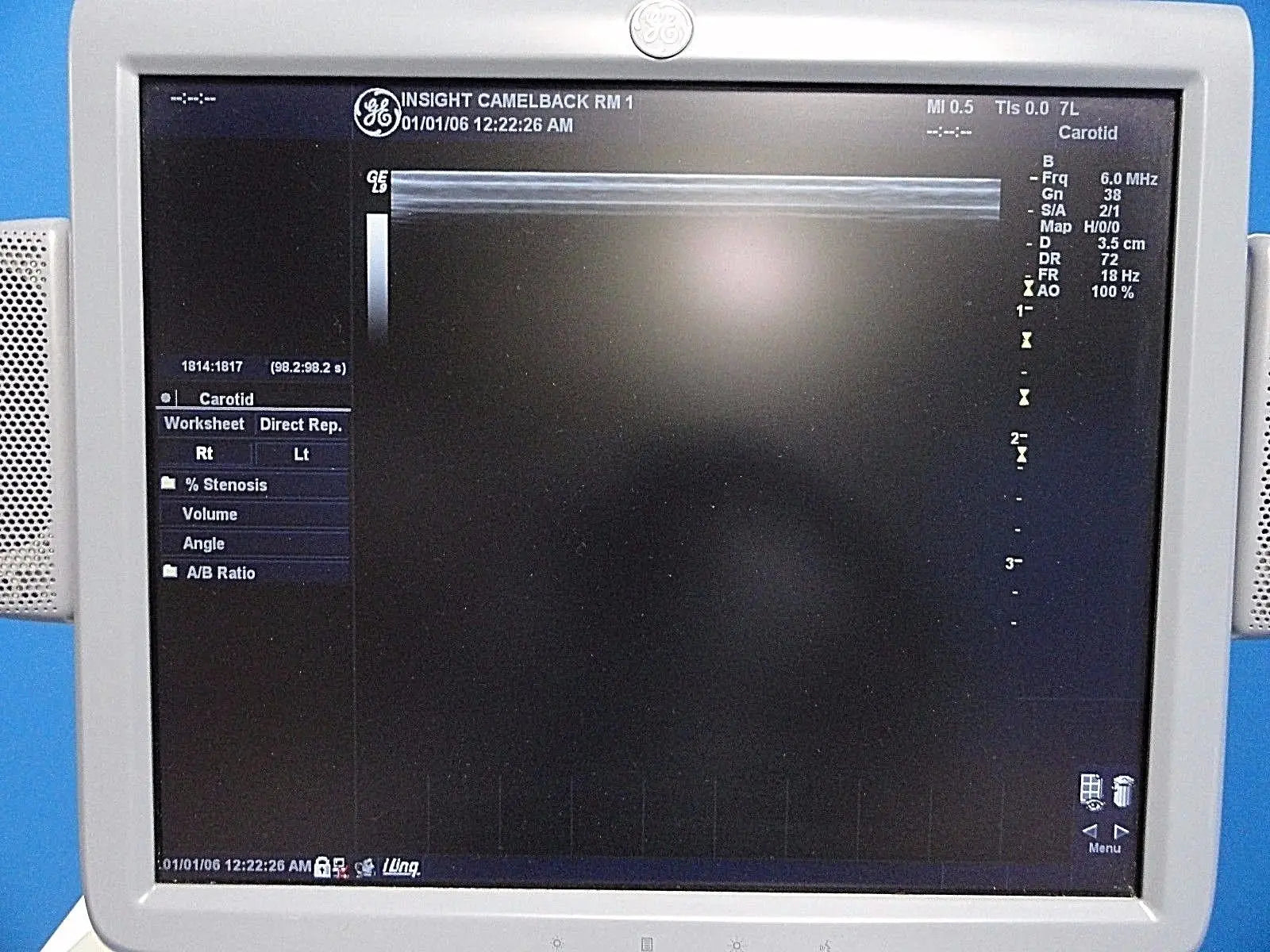 GE 7L / 2302648 Linear Array Ultrasound Probe for Logiq & Vivid Series~13787 DIAGNOSTIC ULTRASOUND MACHINES FOR SALE