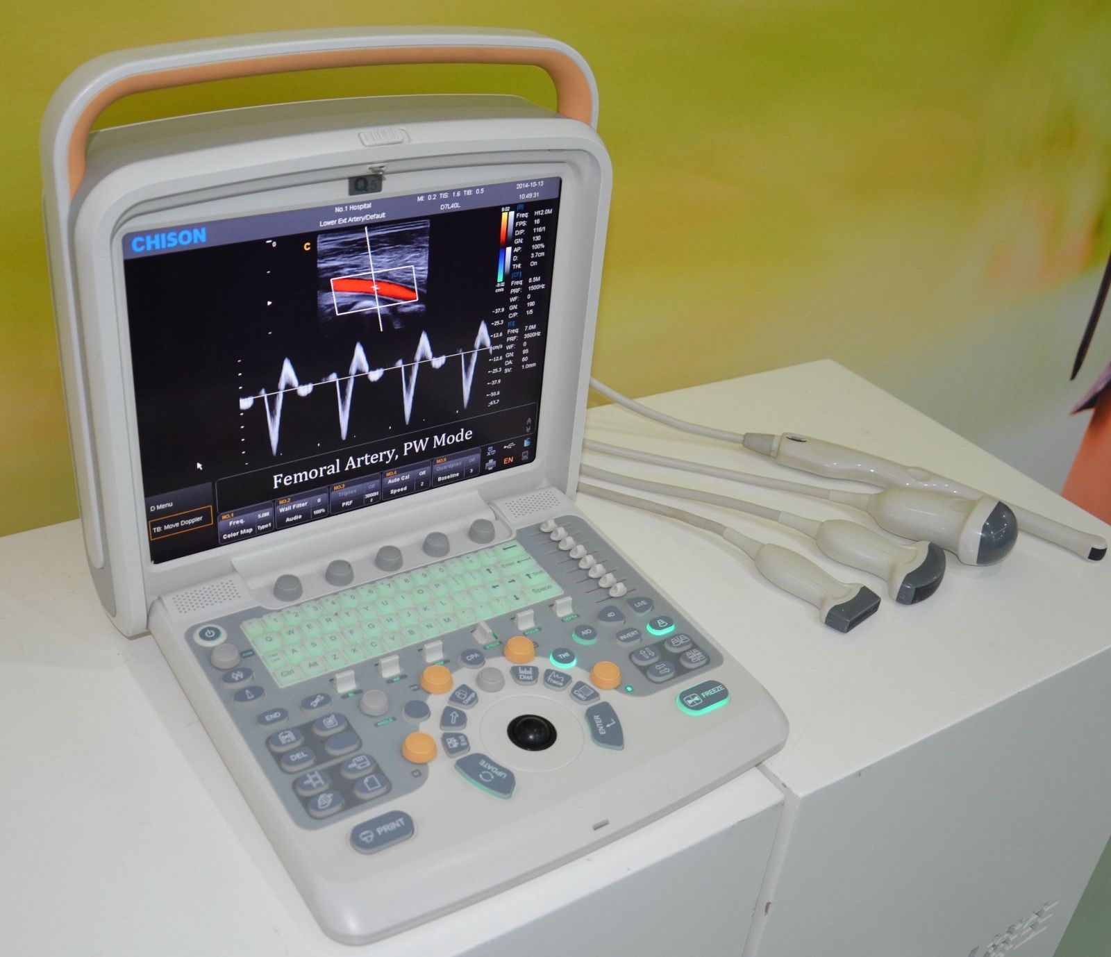 Color Doppler Ultrasound Chison Q5 with Trolley, and Linear Array Probe 5-10Mhz DIAGNOSTIC ULTRASOUND MACHINES FOR SALE