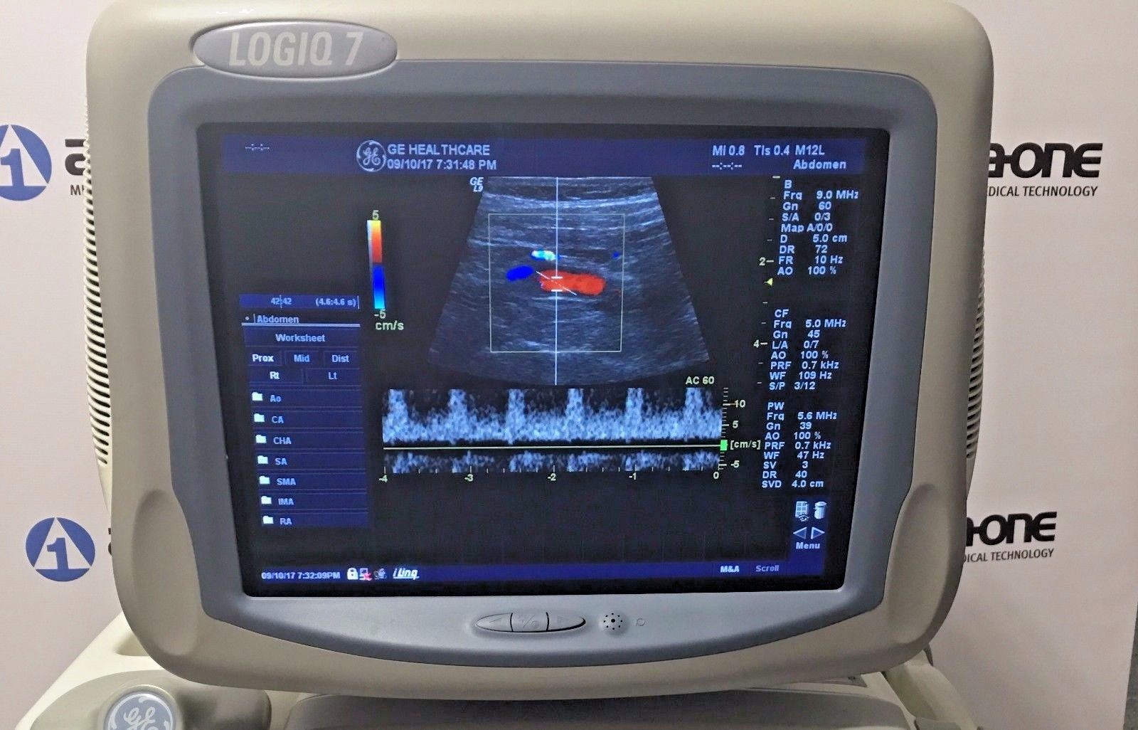 GE Logiq 9 Ultrasound System with 3.5C, E8C, 7L, 10L, and M12L Transducers DIAGNOSTIC ULTRASOUND MACHINES FOR SALE