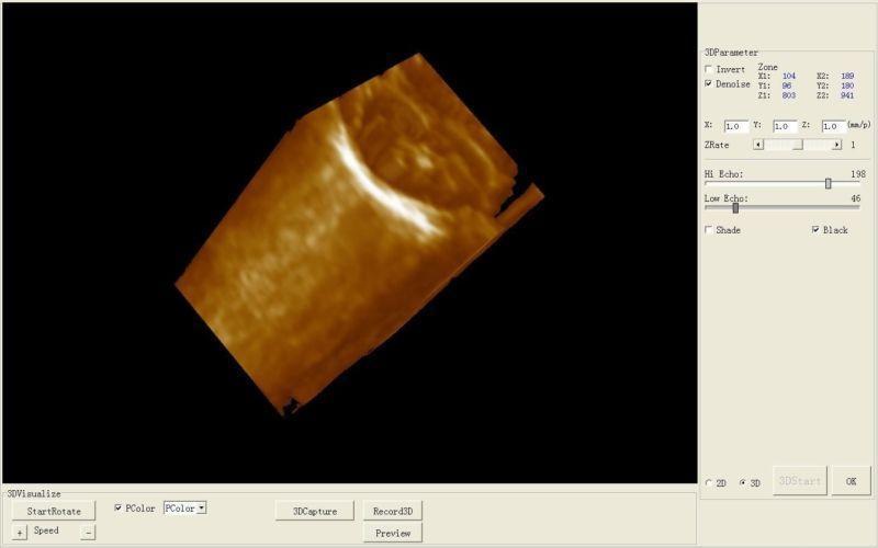 Medical Ultrasonic Ultrasound Machine Covex +Linear+Transvaginal 3 Probes 3D AA DIAGNOSTIC ULTRASOUND MACHINES FOR SALE