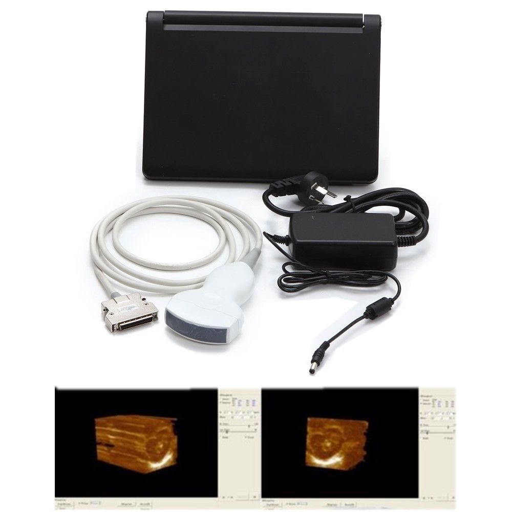 New +3D Software Laptop Ultrasound Machine Scanner system + Linear Probe 7.5MHZ DIAGNOSTIC ULTRASOUND MACHINES FOR SALE