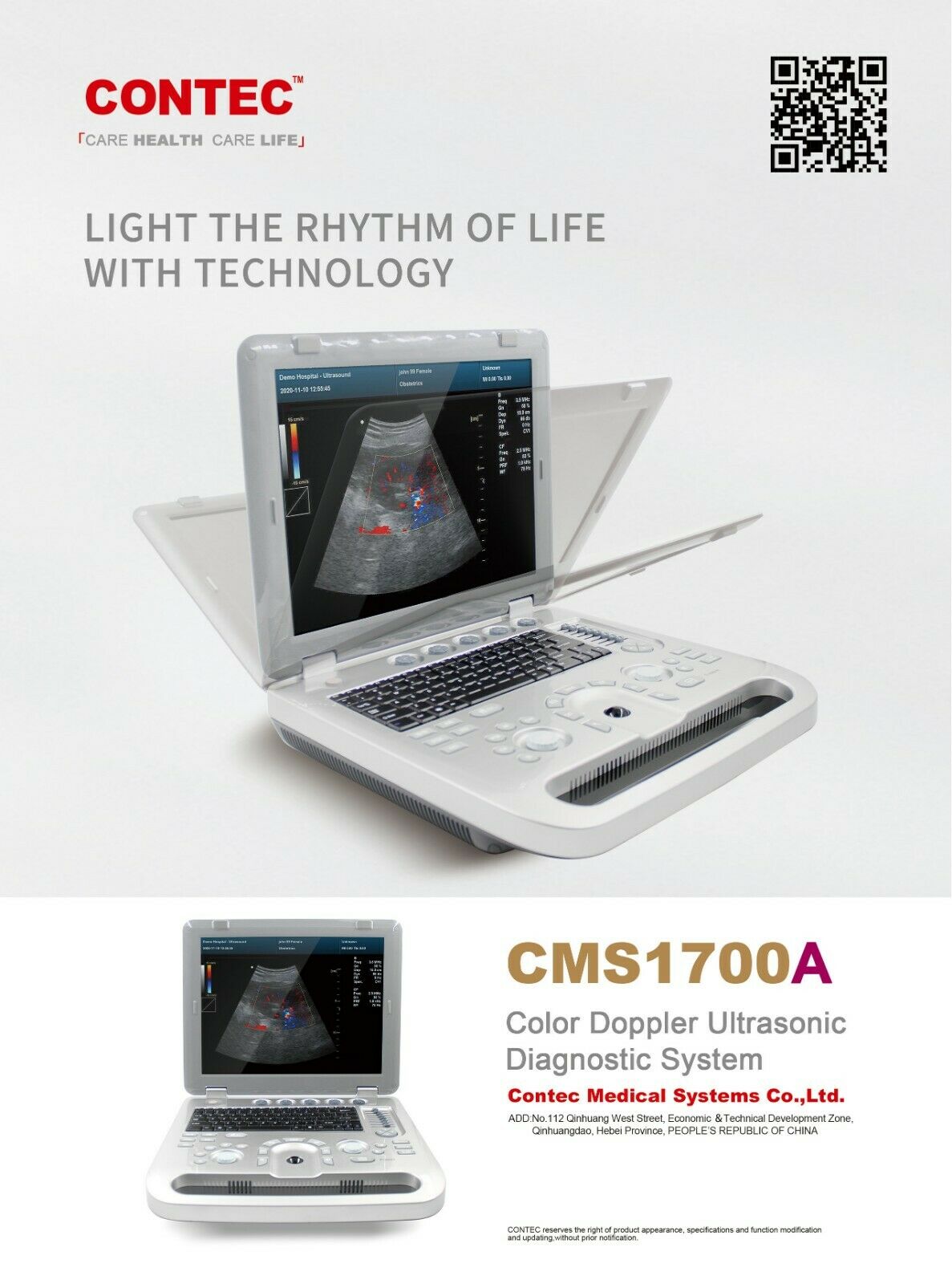 Portable High Resolution Color Doppler Ultrasound Scanner with Convex Probe New 6945040100362 DIAGNOSTIC ULTRASOUND MACHINES FOR SALE