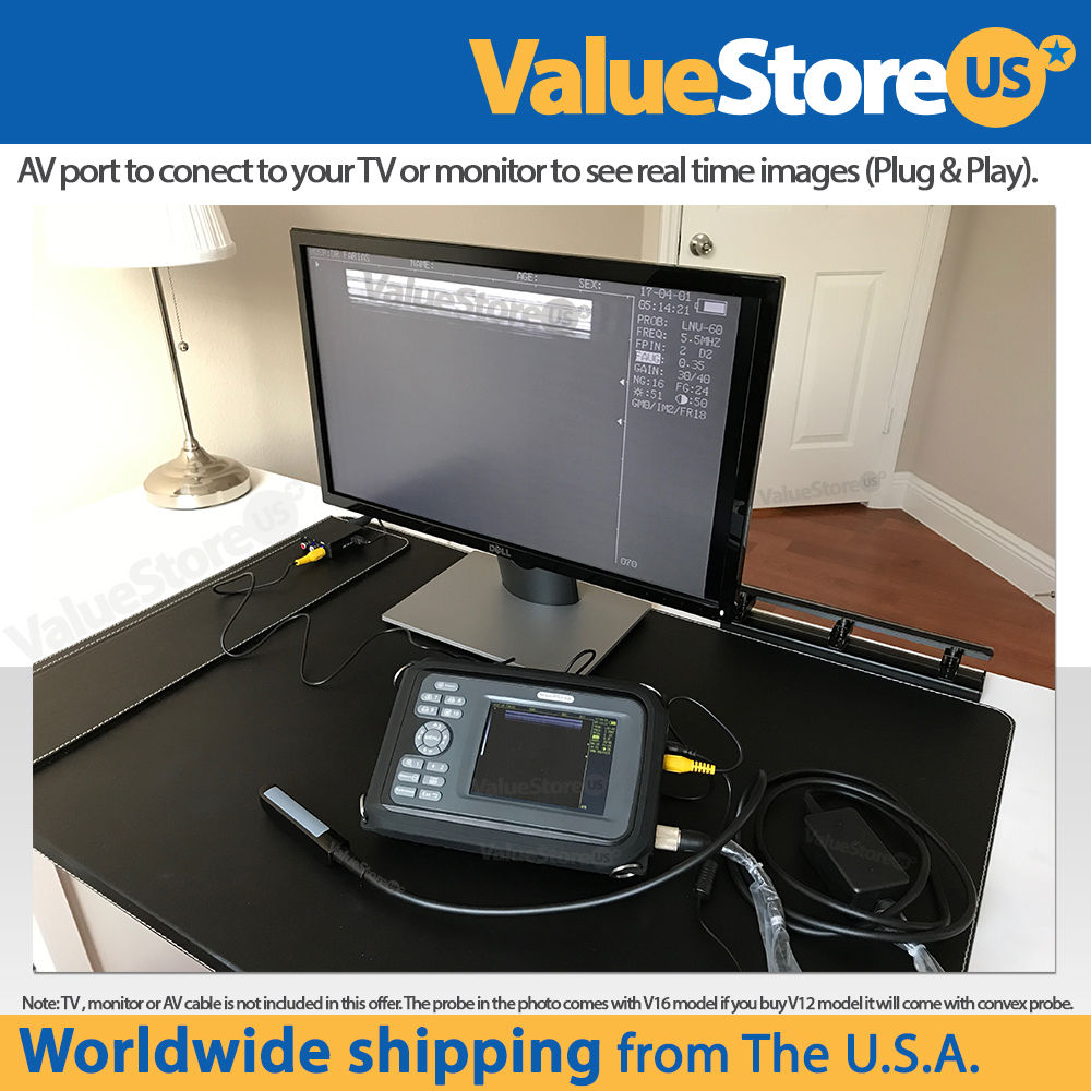 Portable Ultrasound Scanner Veterinary Pregnancy V16 with 7.5 MHz Rectal Linear. 689990773721 DIAGNOSTIC ULTRASOUND MACHINES FOR SALE