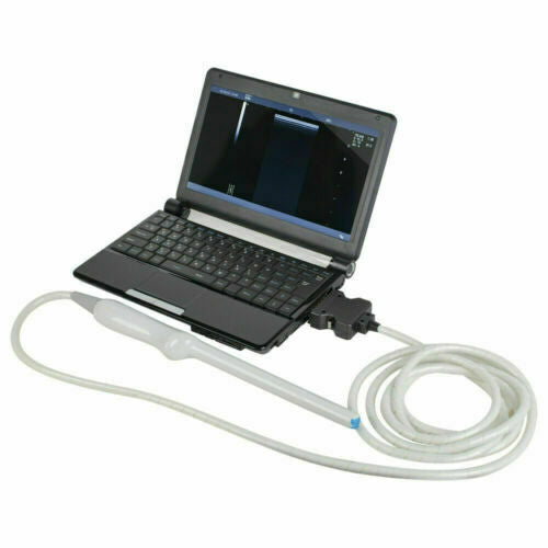 Digital Laptop Ultrasound Scanner Machine Transvaginal Probe Micro Convex Probe DIAGNOSTIC ULTRASOUND MACHINES FOR SALE