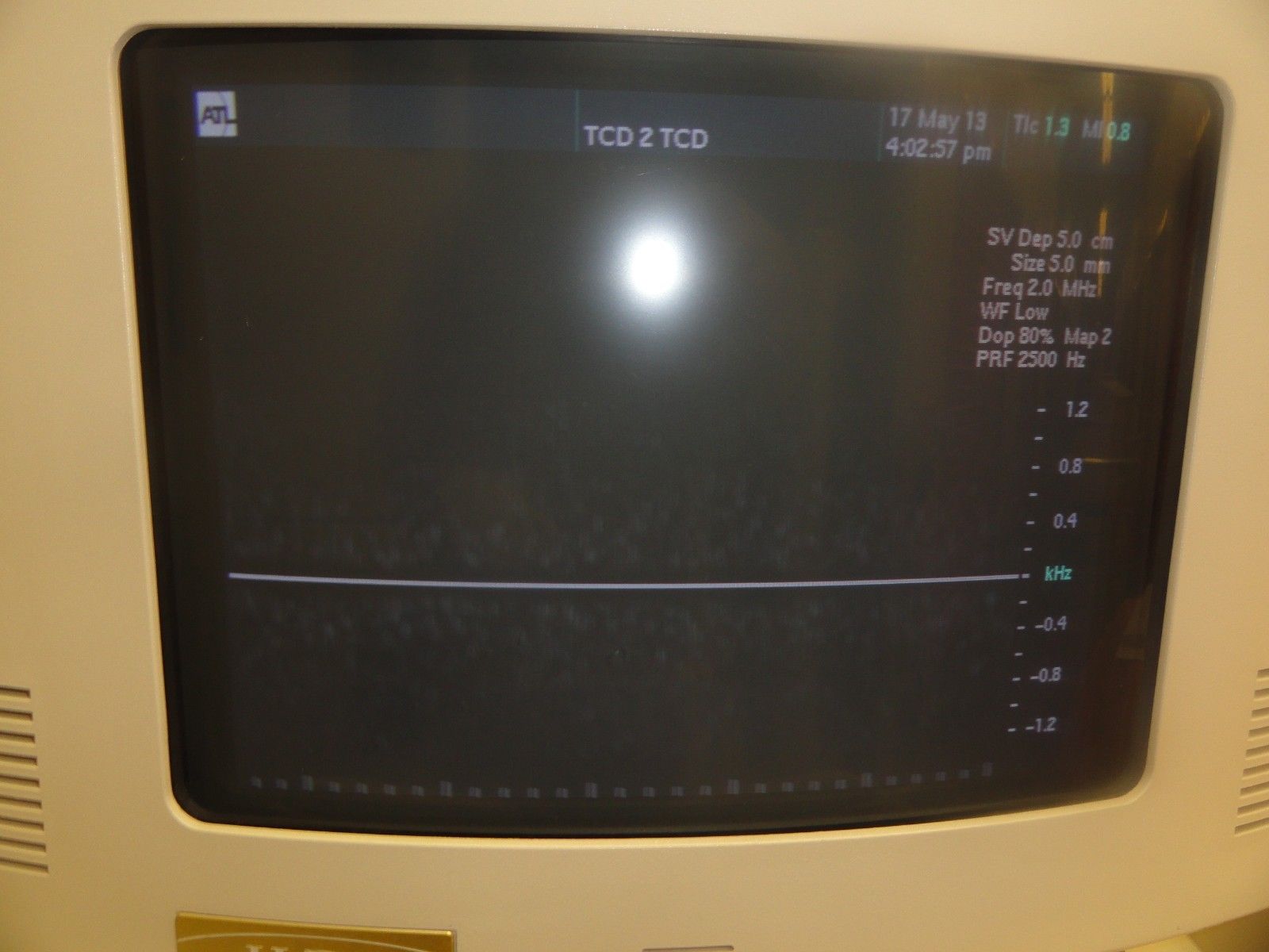 ATL D2TC Static HDI 2.0MHz P/N 4000-0310-02 PW Doppler Transcranial Probe ~5554 DIAGNOSTIC ULTRASOUND MACHINES FOR SALE