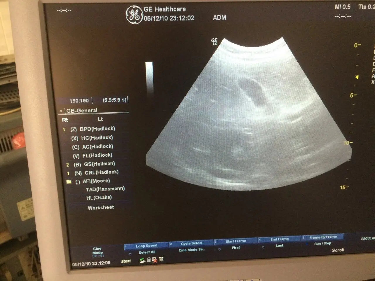 GE Ultrasound transducer probe convex 4CRC DIAGNOSTIC ULTRASOUND MACHINES FOR SALE