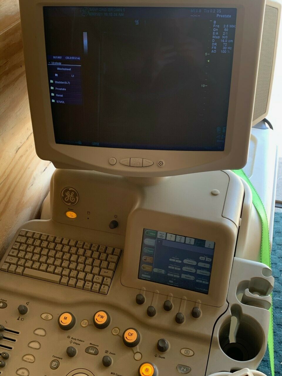 GE Logiq P5 Ultrasound Machine DIAGNOSTIC ULTRASOUND MACHINES FOR SALE
