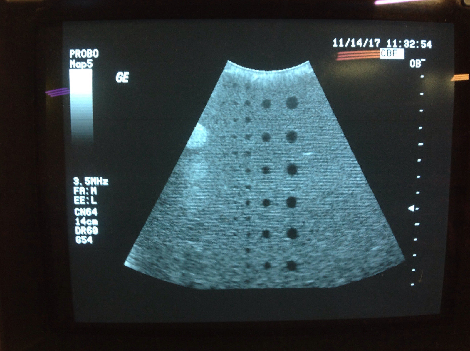 GE CBF 3.5 Ultrasound Probe DIAGNOSTIC ULTRASOUND MACHINES FOR SALE