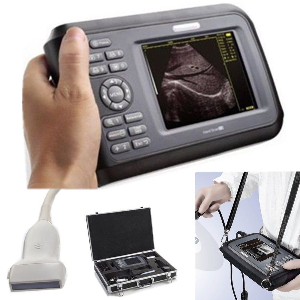 Laptop HandScan Digital Ultrasound machine Scanner system +7.5M HF linear Probe DIAGNOSTIC ULTRASOUND MACHINES FOR SALE