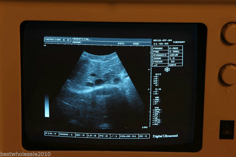Digital Ultrasound Scanner B ultrasonic Machine Convex Micro-Convex 2 probe 3D 190891391452 DIAGNOSTIC ULTRASOUND MACHINES FOR SALE