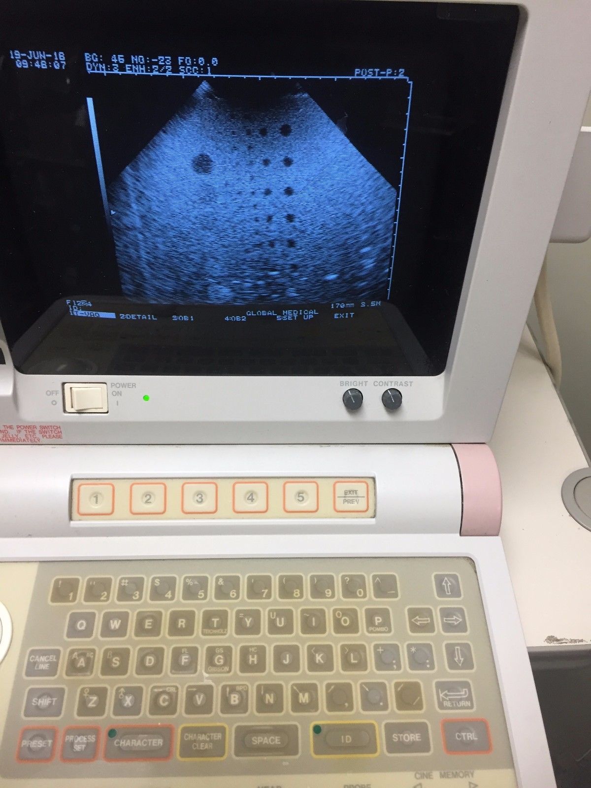 Hitachi EUB-405 Plus Ultrasound / 2 probes / 2 transducer port / printer DIAGNOSTIC ULTRASOUND MACHINES FOR SALE