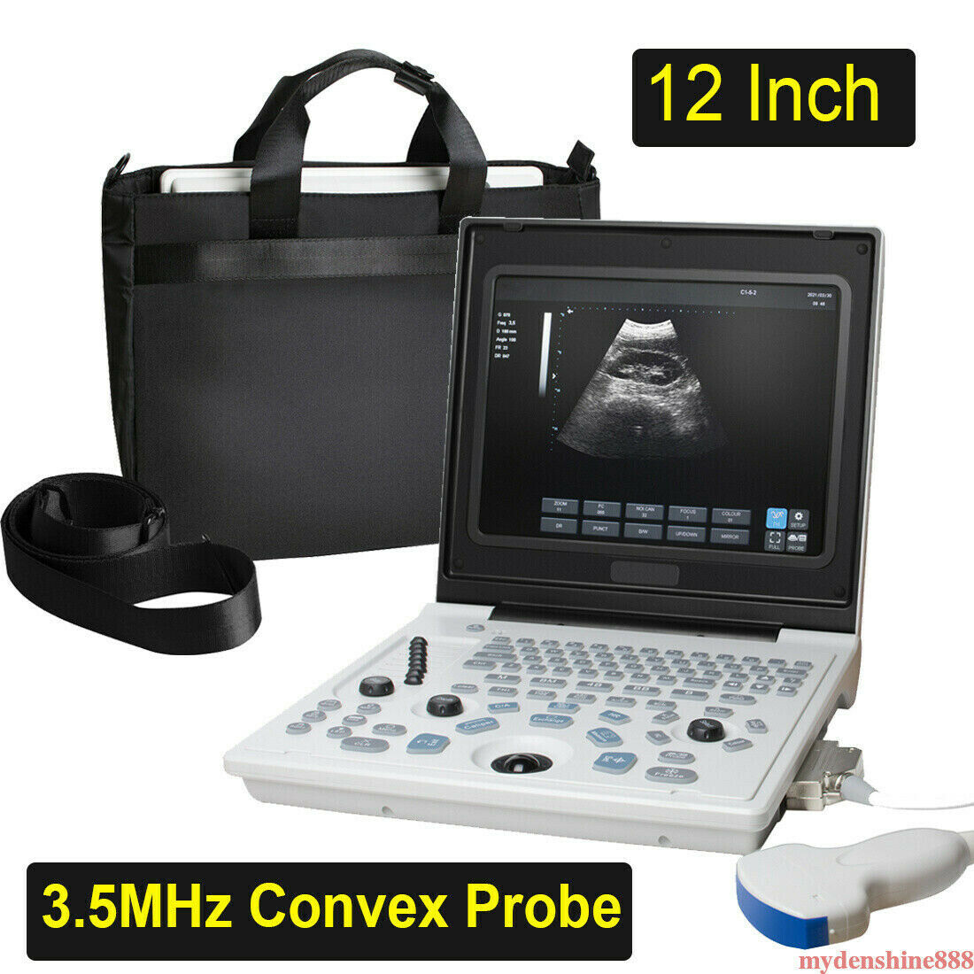 Portable 12" Full Digital Ultrasound Scanner Machine + 3.5MHz Convex Probe Human DIAGNOSTIC ULTRASOUND MACHINES FOR SALE