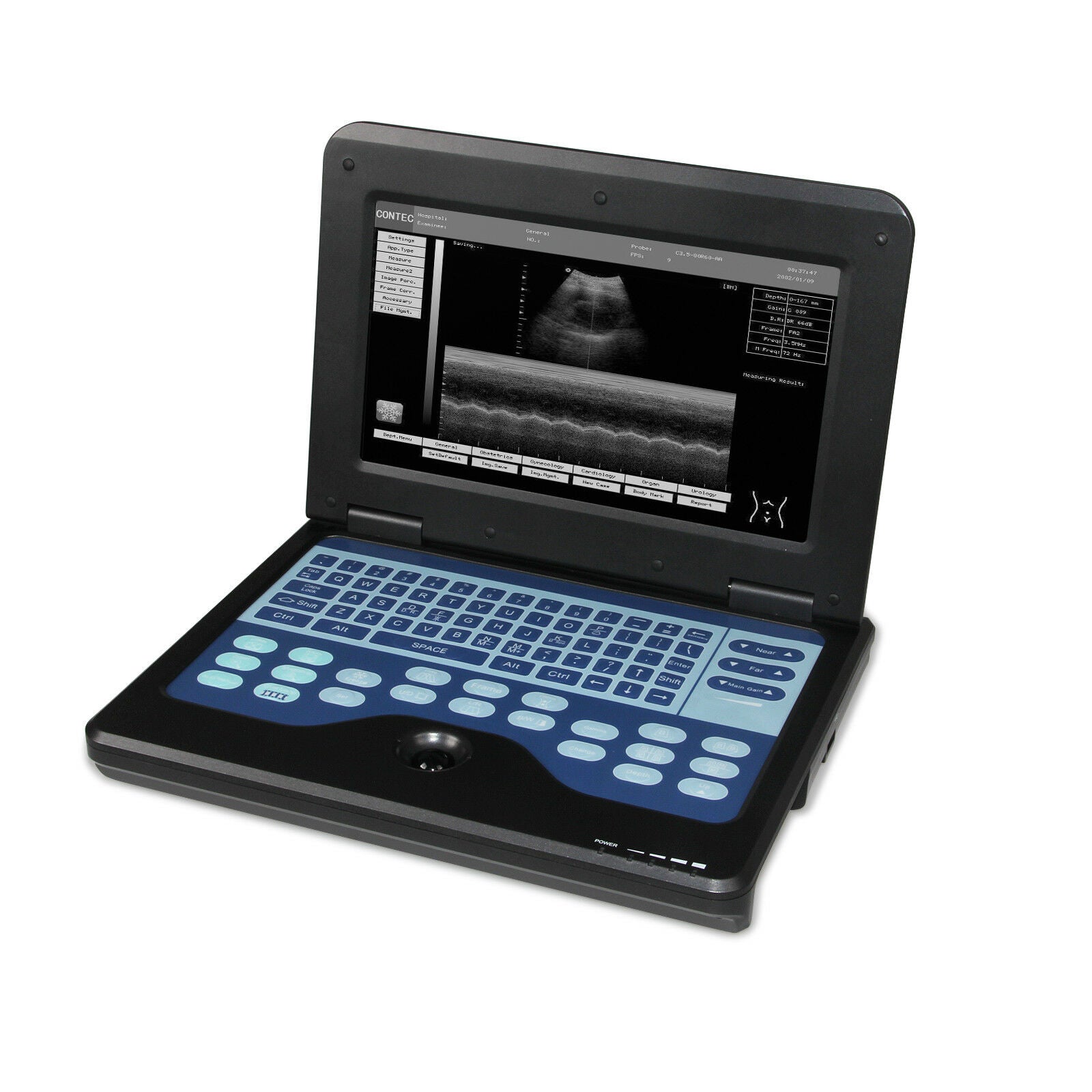 Portable Laptop Digital Ultrasound Scanner High Resolution,Convex/abdominal Prob DIAGNOSTIC ULTRASOUND MACHINES FOR SALE