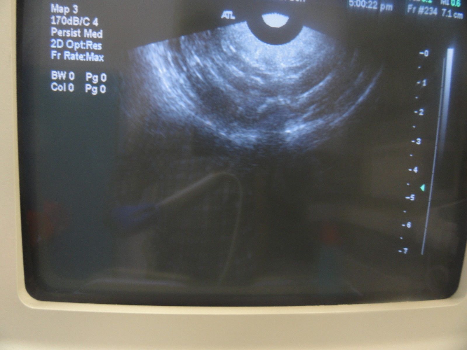 ATL C9-5 ICT Curved Array (Endovaginal/Endorectal) Ultrasound Probe (5941 ) DIAGNOSTIC ULTRASOUND MACHINES FOR SALE