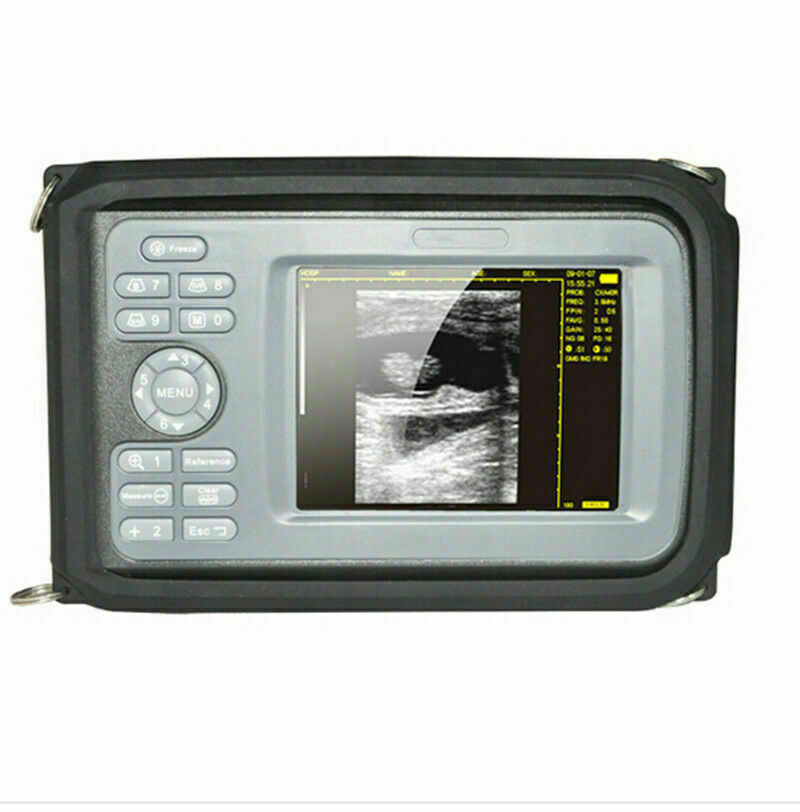 Handscan Ultrasound Scanner Machine Digital For Human Use 3.5Mhz Convex Probe US DIAGNOSTIC ULTRASOUND MACHINES FOR SALE
