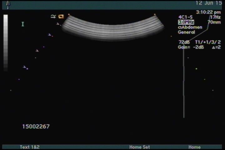 Siemens ACUSON 4C1 Ultrasound Transducer DIAGNOSTIC ULTRASOUND MACHINES FOR SALE
