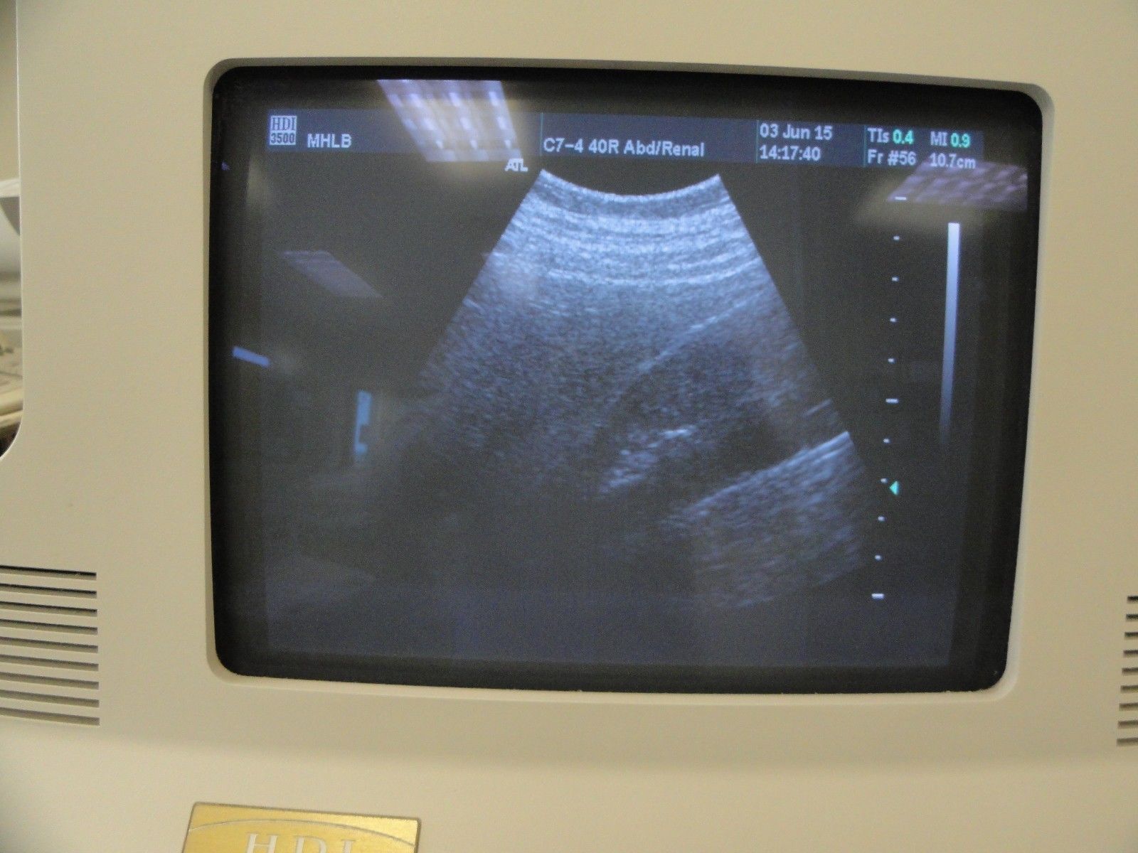 ATL C7-4 40R Curved Array Convex Abdominal Probe for ATL HDI Series (8938 ) DIAGNOSTIC ULTRASOUND MACHINES FOR SALE