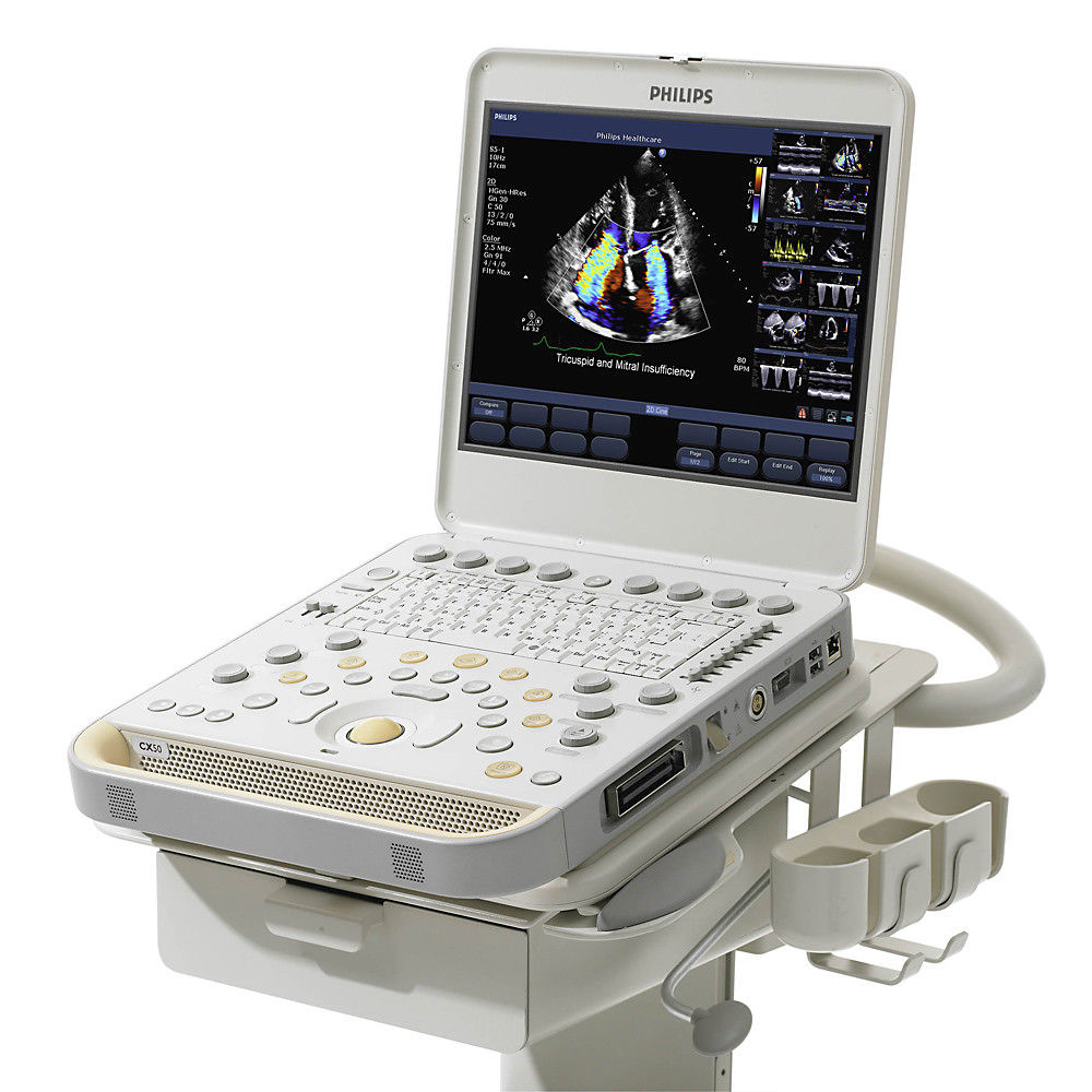 Philips CX50 Portable Ultrasound System with S5-1 Cardiac Sector Transducer DIAGNOSTIC ULTRASOUND MACHINES FOR SALE