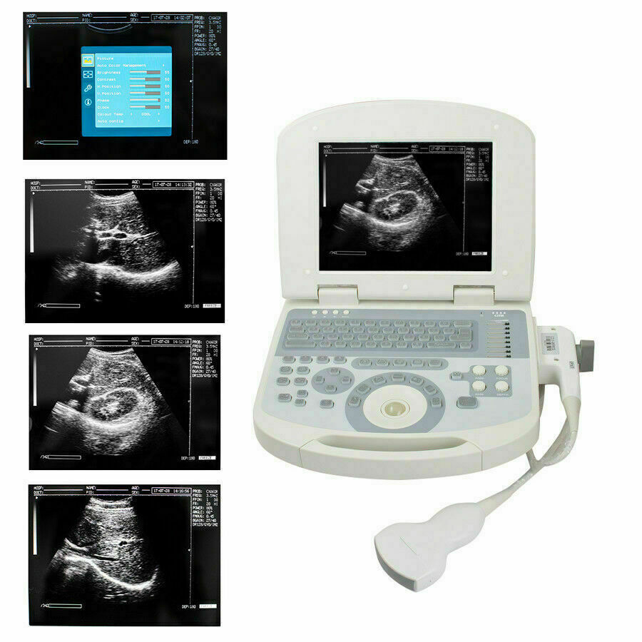 New Portable Laptop Machine Digital Ultrasound Scanner, 3.5 Micro Convex Probe DIAGNOSTIC ULTRASOUND MACHINES FOR SALE