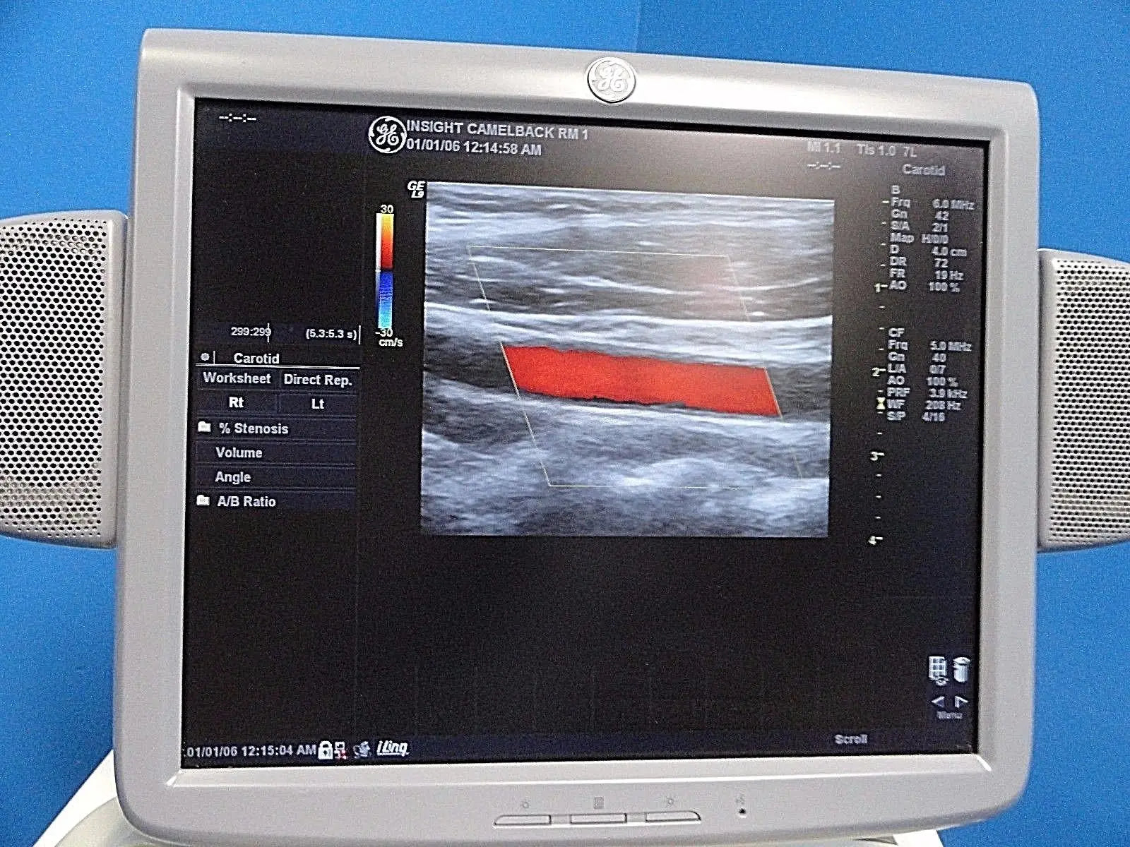 GE 7L Linear Array Ultrasound Probe P/N 2197482 for Logiq & Vivid Series~13729 DIAGNOSTIC ULTRASOUND MACHINES FOR SALE