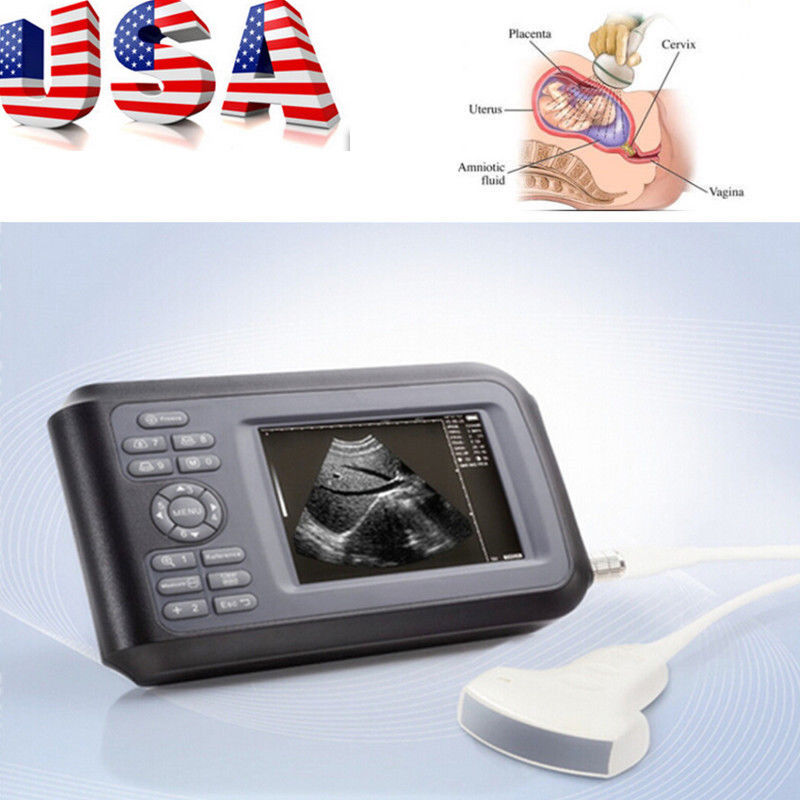 Portable HandScan 5.5'' Digital Ultrasound Scanner Machine+Convex Probe+Oximeter 190891400826 DIAGNOSTIC ULTRASOUND MACHINES FOR SALE
